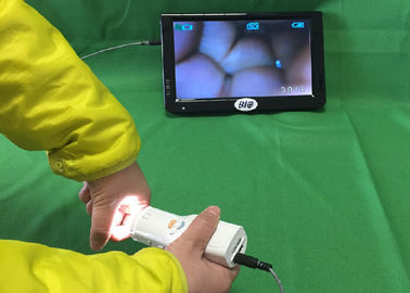 X 1.5 Vergroting Digitale Elektronische Colposcope verbindt met TV of Computer of Medische Monitor voor Vrouwen 's Gezondheid