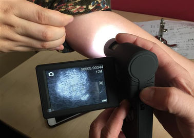 Videohuidmicroscoop Draagbare Dermatoscope met de Kleuren Draaibare Vertoning van 3 Duimtft
