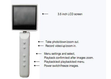 De handbediende Oftalmoscoop van de Videocamera Kenmerkende Video Digitale Oorspiegel met USB-Verbinding van Output de Facultatieve WIFI