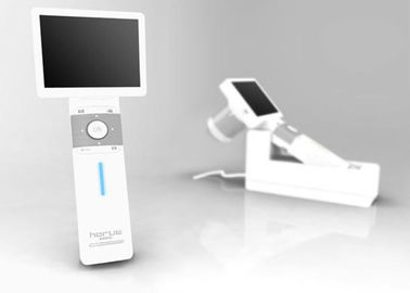 ENT Volledige Digitale Inspectie van de Endoscoop Digitale Videooorspiegel met de Oorspiegel van USB van de SD-geheugenkaartoutput