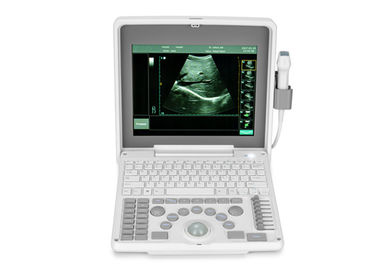 De digitale Draagbare Mobiele Laptop Medische apparatuur BIO3000j van de Ultrasone klankscanner met het 1,12 Duim LEIDENE Scherm