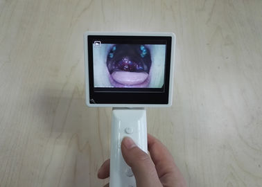 Digitale Videorhinoscope-Laryngoscoopcamera voor Neuskeelinspectie met 3,5 Duimlcd het Scherm