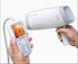 Digitale Handbediende Cervicale Camera Colposcope voor Gynaecologie om Cervix met 80.0000 het Gezoem van de Pixelresolutie te inspecteren 1~128