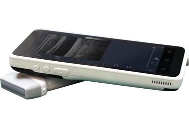 Het mini Handbediende Sonogram Apparaat van Kleurendoppler met 128 Elementen1280*720 Resolutie