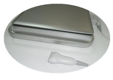 3d de Ultrasone klankscanner/Hand van Kleurendoppler - gehouden Doppler met Ingebouwde Batterij