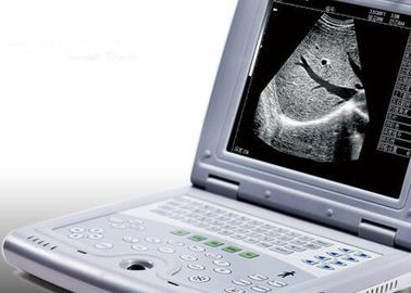 Draagbare Ultrasone klankmachine voor de Scanner slechts 2.2kgs Gewicht van de Zwangerschaps Draagbaar Ultrasone klank