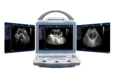 Scanner van de de Machine de Draagbare Ultrasone klank van de het ziekenhuisultrasone klank met Dubbele Sondeschakelaars