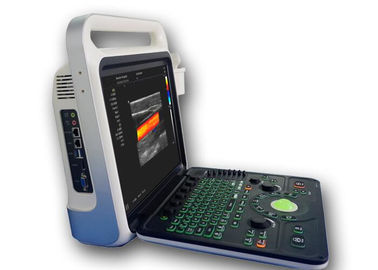 Scanner van de de Machine de Draagbare Ultrasone klank van de ultrasone klankweergave met 160G-Capaciteit