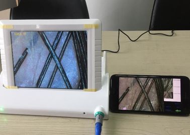 Digitale Handbediende Videodermatoscope de Huidanalysator van Magnifier met Gegevensrapport van Flexibele het Pigment van de Olievochtigheid