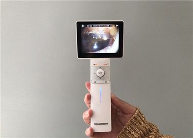 Van micro- van de het Oorcamera SD-geheugenkaartusb Digitale Video de Oorspiegel Algemene Weergave en Dermatoscope