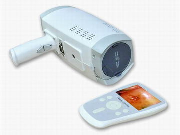 Lensresolutie 800000 Pixel Digitale Elektronische Colposcope met Automatisch Elektronisch Blind het 3.5 Duim Handbediende Scherm