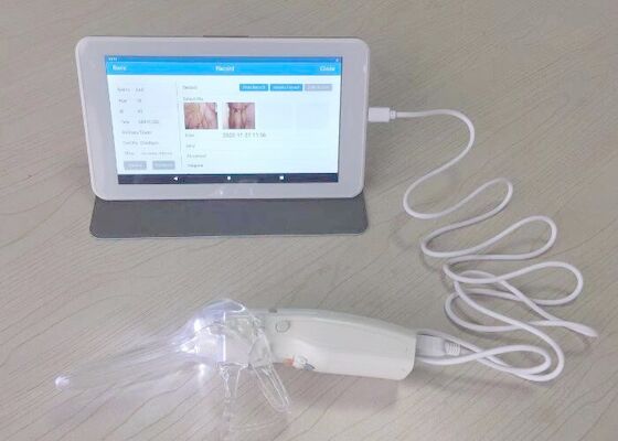 Digitale Videocolposcope voor Vrouwenzorg Professionele Camera van de 10 of 7 Duim de Medische Monitor voor Inspectie van Cervix