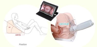 Gezondheidszorgproduct Gynaecologische Endoscopische Digitale Elektronische Colposcope voor het Gebruik van het Vrouwenhuis