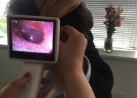 De Oorspiegelcamera van USB van het 3,5 Duimscherm Medische Digitale Video met de Duidelijke Facultatieve Laryngoscoop van Beeldrhinoscope
