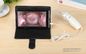 De vaginale Camera Digitale Elektronische Videocolposcope van de Cameracervix voor Gyneclogy-Inspectie met Beschikbare Dilatator