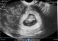 Transvaginale endocavity draagbare zwangerschapsscanner voor OB / GYN draagbare echografie