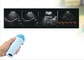 Handheld Blaas Draagbare Scanner Micro Convex Probe Ultrasound Veterinaire Zwangerschap