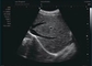 Doppler-echografie tijdens de zwangerschap Thuis Doppler-echografiesonde Frequentie 12 MHz