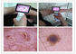 Klinische ENT Inspectie van Menselijk Lichaams Digitale Videooorspiegel met de Oorspiegel van Kleurentft lcd USB