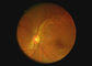 De oog Optische van de de Camera Videooorspiegel van de Materiaalkeel Digitale Endoscoop van Dermatoscope met 2 Miljoen Pixel