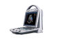 Het volledige Digitale Apparaat van de de Machine 2D Ultrasone Kenmerkende Scanner van Kleurendoppler