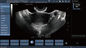Transvaginal de Ultrasone klankscanner van Doppler van de Sondekleur, Handbediende Doppler-Zwangerschap