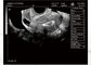 De draagbare Scanner van de de Machine Draagbare Ultrasone klank van de Babyultrasone klank voor Pediatrie