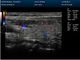 De digitale Draagbare Beweegbare Kleur Doppler van de Ultrasone klankscanner met het 15 Duim LEIDENE Scherm