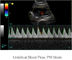 Van het de Ultrasone klanksysteem van kleurendoppler Draagbare de Ultrasone klankscanner met 12,1 Duim HOOFDmonitor en 2 Sondehavens