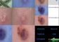 Huid en Scalp Detector Videodermatoscope met Analysisi-Rapport van Flexibele het Pigment van de Vochtigheidsolie