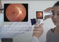 Fundus van de oogdiagnose Digitaal Cameramateriaal aan Fundus Ziekten