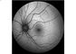 Het Digitale Oogmateriaal 160° van retinaangiograph
