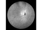 Fundus van het laseraftasten Camera Professioneel Oogmateriaal met Fundus Minimum de Leerlingsgrootte van weergavegezichtsveld 160° 2 mm