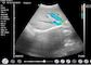 De Ultrasone klank Draagbare Kenmerkende Hand van huisdoppler - gehouden Doppler-de Pediatrietoepassing van de Ultrasone klank Obstetrische Gynaecologie