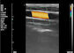 Van het de Machinehuis van de kleurenultrasone klank van de de Ultrasone klankscanner de Draagbare Ultrasone klank voor Zwangerschap 8 TGC 3.5~10 Mhz