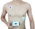 Regelbaar Parameters Micro- Ambulant Draagbaar ECG Apparaat voor Hartzorg