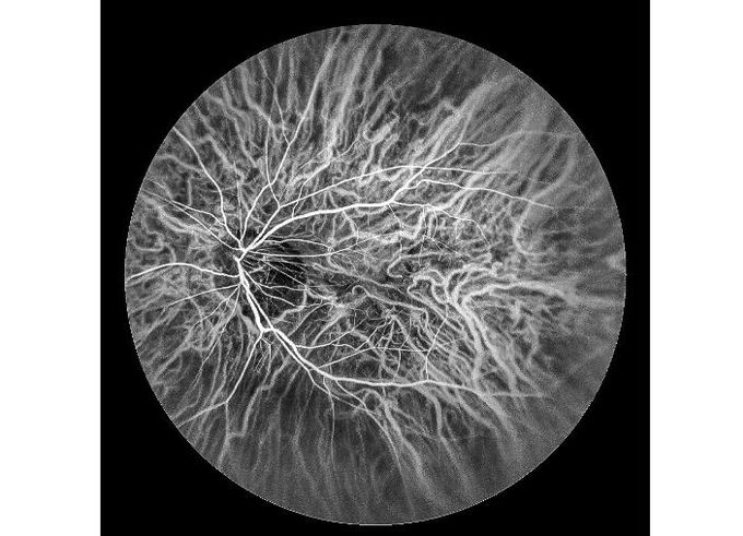 Het ultra-brede van de het Aftastenretina van de Gebiedslaser Materiaal van Angiograph Digitale Oog met Optische zoomfuncties 100°/60°/30°
