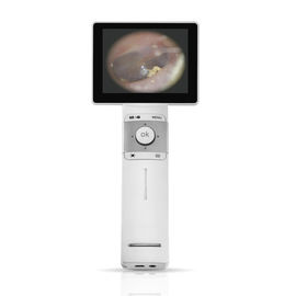 Digitale Videooorspiegel Volledige Digitale Inspectie met BR-de Oorspiegel van USB van de Kaartoutput