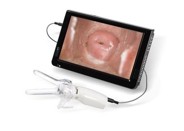 Minicolposcope voor de Cervicale Vaginale die Camera van Examintion aan TV of PC wordt aangesloten