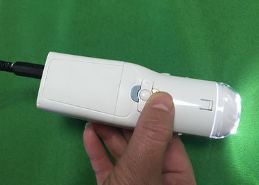 Vaginale Camera Digitale Elektronische Colposcope om Ziekte van Cervix Eealier te vinden