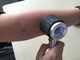 Aangepaste Gezondheidszorg Handbediende Medische Dermatoscope voor Huidinspectie