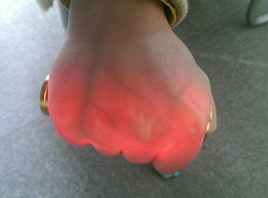 Het draagbare Vasculaire van de de Adervinder van Projectorvenipuncture Infrarode van het de Adermerkteken Gouden Aluminium