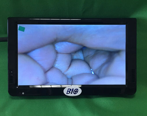 Draagbare Digitale Elektronische Colposcoop