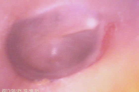 720X480 Digital Video Otoscoop