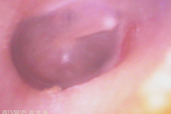 720X480 Digital Video Otoscoop