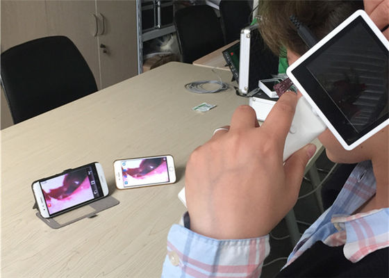 720X480 Digital Video Otoscoop