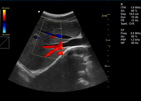 van de Machine Draagbare Doppler van Doppler van de 15 duim Volledige Digitale Kleur de Weergaveultrasone klank met USB-poort 2