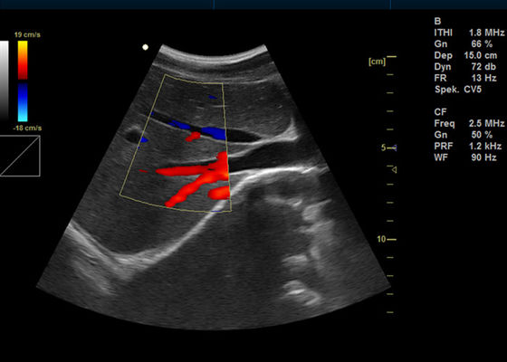 van de Machine Draagbare Doppler van Doppler van de 15 duim Volledige Digitale Kleur de Weergaveultrasone klank met USB-poort 2