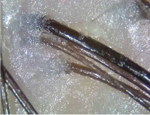 Het draagbare Draadloze Digitale Apparaat van de de Telegeneeskundediagnose van de Huidanalysator met polariseert Licht