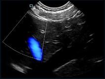 De mini van de de Scannerkleur van de Zak Handbediende Ultrasone klank Sonde van Doppler Veranderlijk met Frequentie van 2~11MHz